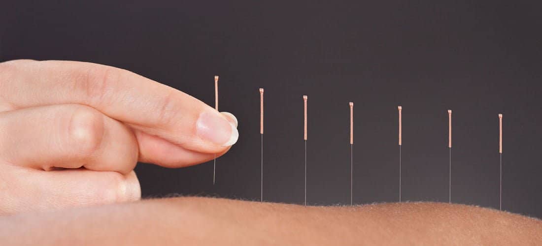 Akupunktur Eğitimi